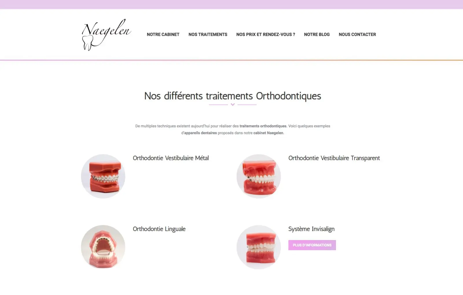 Les différents traitements orthodontiques, une agence web situé à Mulhouse